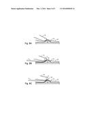 Apparatus for safely and accurately excising core tissue samples from     palpated nodules or surface lesions diagram and image