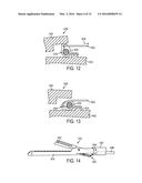 Devices and Methods for Facilitating Closing and Clamping of an End     Effector of a Surgical Device diagram and image