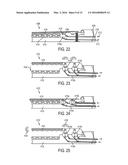 Devices and Methods for Facilitating Closing and Clamping of an End     Effector of a Surgical Device diagram and image