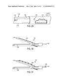 Devices and Methods for Facilitating Closing and Clamping of an End     Effector of a Surgical Device diagram and image