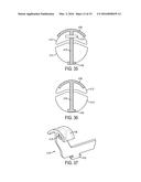 Devices and Methods for Facilitating Closing and Clamping of an End     Effector of a Surgical Device diagram and image