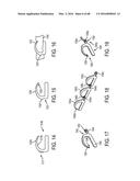 Devices and Methods for Facilitating Ejection of Surgical Fasteners from     Cartridges diagram and image