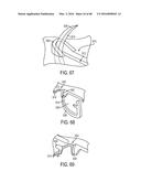 Devices and Methods for Facilitating Ejection of Surgical Fasteners from     Cartridges diagram and image