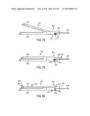 Devices and Methods for Facilitating Ejection of Surgical Fasteners from     Cartridges diagram and image