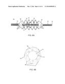 CLOT RETRIEVAL CATHETER diagram and image