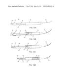 CLOT RETRIEVAL CATHETER diagram and image