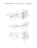 System and Method of Soft Tissue Anchoring to Metaphyseal Bone Plate diagram and image