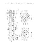 METHOD FOR PAINLESS RENAL DENERVATION USING A PERI-VASCULAR TISSUE     ABLATION CATHETER WITH SUPPORT STRUCTURES diagram and image