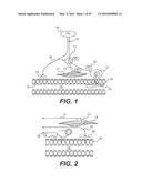 DEVICES FOR DAMAGING NERVES AND RELATED METHODS OF USE diagram and image