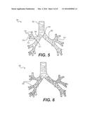 DEVICES FOR DAMAGING NERVES AND RELATED METHODS OF USE diagram and image