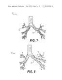 DEVICES FOR DAMAGING NERVES AND RELATED METHODS OF USE diagram and image