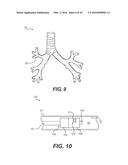 DEVICES FOR DAMAGING NERVES AND RELATED METHODS OF USE diagram and image