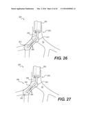 DEVICES FOR DAMAGING NERVES AND RELATED METHODS OF USE diagram and image