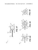 DEVICES FOR DAMAGING NERVES AND RELATED METHODS OF USE diagram and image