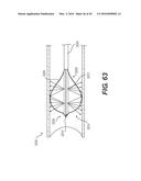 DEVICES FOR DAMAGING NERVES AND RELATED METHODS OF USE diagram and image