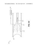 DEVICES FOR DAMAGING NERVES AND RELATED METHODS OF USE diagram and image