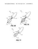 DEVICES FOR DAMAGING NERVES AND RELATED METHODS OF USE diagram and image