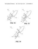 DEVICES FOR DAMAGING NERVES AND RELATED METHODS OF USE diagram and image