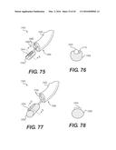 DEVICES FOR DAMAGING NERVES AND RELATED METHODS OF USE diagram and image