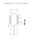 DEVICES FOR DAMAGING NERVES AND RELATED METHODS OF USE diagram and image