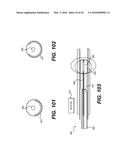 DEVICES FOR DAMAGING NERVES AND RELATED METHODS OF USE diagram and image