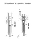 DEVICES FOR DAMAGING NERVES AND RELATED METHODS OF USE diagram and image