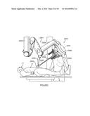 SURGICAL SYSTEM INSTRUMENT MOUNTING diagram and image