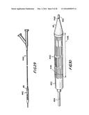 FILTER APPARATUS FOR OSTIUM OF LEFT ATRIAL APPENDAGE diagram and image