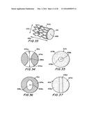 FILTER APPARATUS FOR OSTIUM OF LEFT ATRIAL APPENDAGE diagram and image