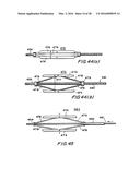 FILTER APPARATUS FOR OSTIUM OF LEFT ATRIAL APPENDAGE diagram and image