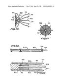 FILTER APPARATUS FOR OSTIUM OF LEFT ATRIAL APPENDAGE diagram and image