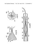 FILTER APPARATUS FOR OSTIUM OF LEFT ATRIAL APPENDAGE diagram and image