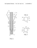 Anti-Leakage Prosthesis diagram and image