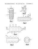 KNOTLESS GRAFT FIXATION ASSEMBLY diagram and image