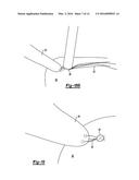 KNOTLESS GRAFT FIXATION ASSEMBLY diagram and image