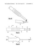 KNOTLESS GRAFT FIXATION ASSEMBLY diagram and image