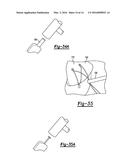 KNOTLESS GRAFT FIXATION ASSEMBLY diagram and image