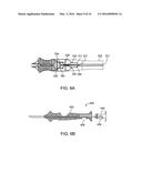 NASAL IMPLANTS AND SYSTEMS AND METHOD OF USE diagram and image