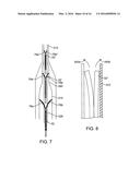 NASAL IMPLANTS AND SYSTEMS AND METHOD OF USE diagram and image