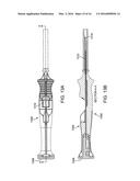 NASAL IMPLANTS AND SYSTEMS AND METHOD OF USE diagram and image