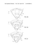 PROSTHETIC SOCKET WITH AN ADJUSTABLE HEIGHT ISCHIAL SEAT diagram and image