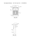 PROSTHETIC SOCKET WITH AN ADJUSTABLE HEIGHT ISCHIAL SEAT diagram and image