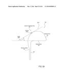 PROSTHETIC SOCKET WITH AN ADJUSTABLE HEIGHT ISCHIAL SEAT diagram and image