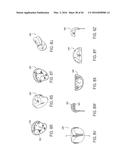 PROSTHETIC SOCKET WITH AN ADJUSTABLE HEIGHT ISCHIAL SEAT diagram and image