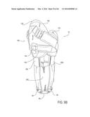 PROSTHETIC SOCKET WITH AN ADJUSTABLE HEIGHT ISCHIAL SEAT diagram and image