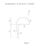 PROSTHETIC SOCKET WITH AN ADJUSTABLE HEIGHT ISCHIAL SEAT diagram and image