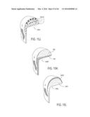 PROSTHETIC SOCKET WITH AN ADJUSTABLE HEIGHT ISCHIAL SEAT diagram and image