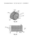 INTRAVASCULAR ANEURYSM TREATMENT DEVICE AND METHODS diagram and image