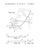 Sleep Apnea Prevention diagram and image