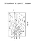 SYSTEMS FOR PATIENT SUPPORT SURFACE ORIENTATION AND DISPLACEMENT diagram and image